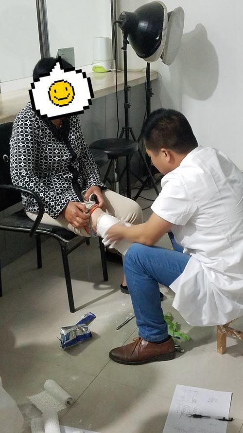 市残疾人辅助器具服务中心开展鄠邑区假肢装配项目集中取型工作