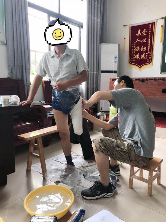 西安市残疾人康复中心赴周至县开展假肢取型工作